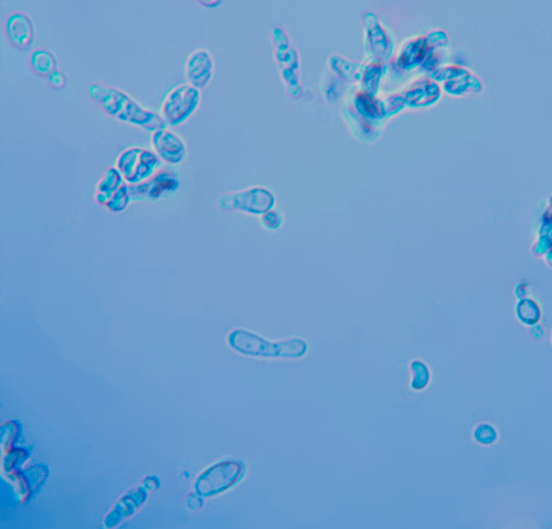 Schizosaccharomyces pombe
