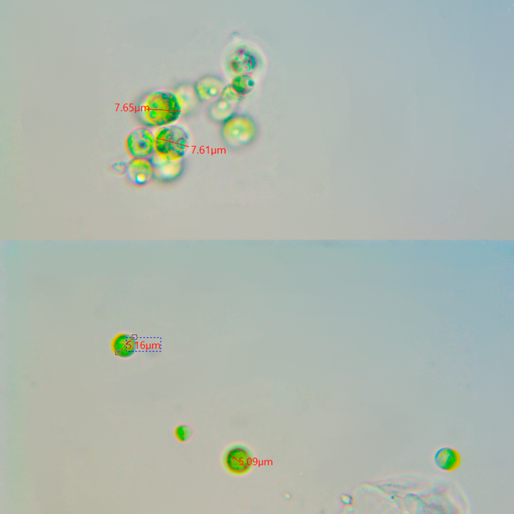 Efectos del etanol en el cultivo de Chlorella vulgaris: gigantismo.